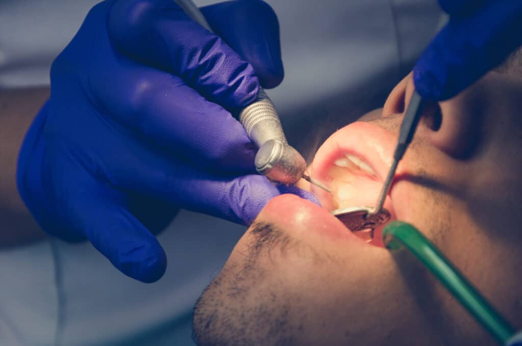 Dental Sedation & Anesthesia