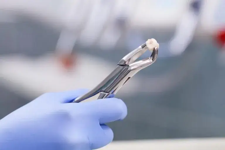 tooth extraction